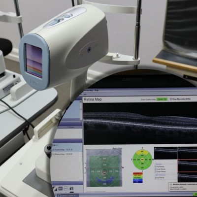 Ocular Coherence Tomography OCT